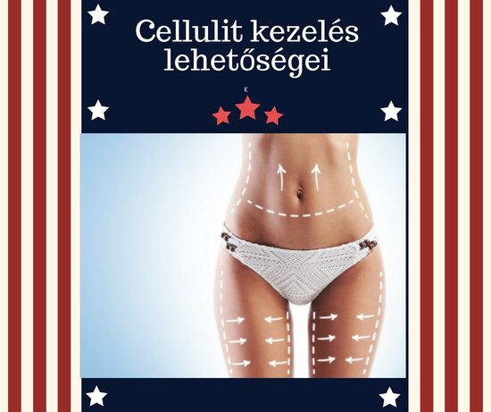 Kavitációs zsírbontás